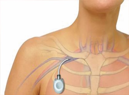 مراقبت از پورت